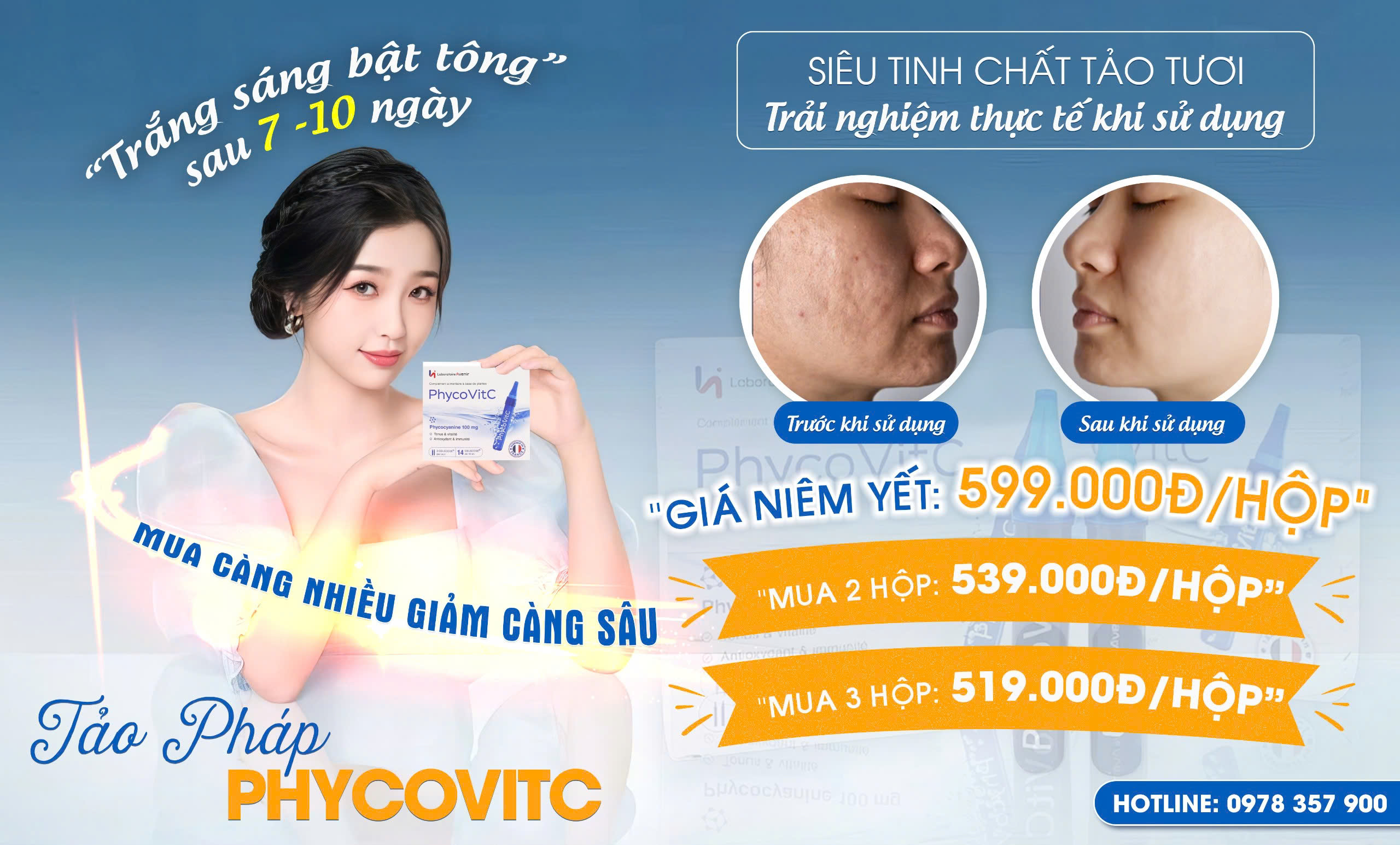 Chuyên gia cảnh báo suy giảm miễn dịch: Tảo tươi Pháp Phycovitc trở thành “lá chắn xanh” cho sức khỏe người Việt?