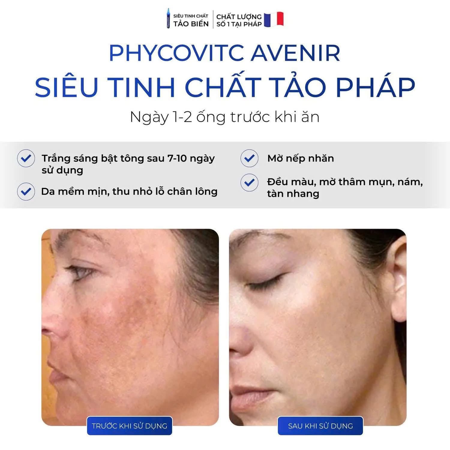 Chuyên gia cảnh báo suy giảm miễn dịch: Tảo tươi Pháp Phycovitc trở thành “lá chắn xanh” cho sức khỏe người Việt?